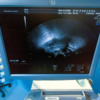 Used - Good GE Voluson E8 Expert - Image 3