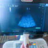 Used - Good ESAOTE MyLab Seven - Image 19