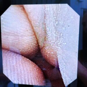 Used – Good OLYMPUS URF-V