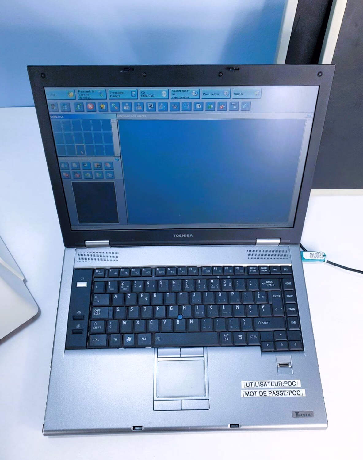 Used - Good KODAK OREX PcCR 1417 - Image 6