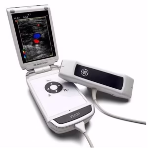 New GE Vscan portable ultrasound device