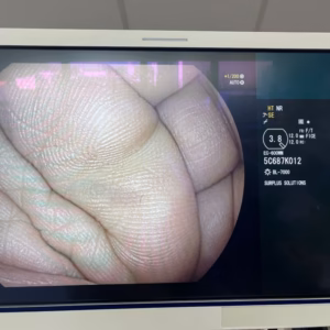 FUJINON EC-600WM Video colonoscope - Image 2