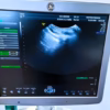 GE Voluson S6 Ultrasound machine with 2 probes and printer - Image 13