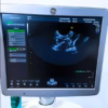 GE Voluson S6 Ultrasound machine with 2 probes and printer - Image 14