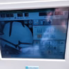 Ziehm Imaging Vision R C-ARM - Image 4